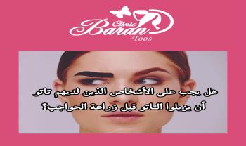 هل يجب على الأشخاص الذين لديهم تاتو أن يزيلوا التاتو قبل زراعة الحواجب؟